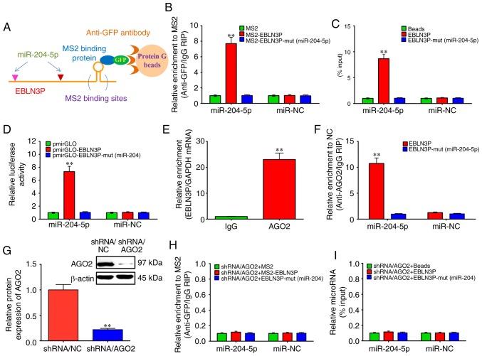 https://cdn.ncbi.nlm.nih.gov/pmc/blobs/2478/7169660/c00221a84bad/IJMM-45-06-1851-g01.jpg