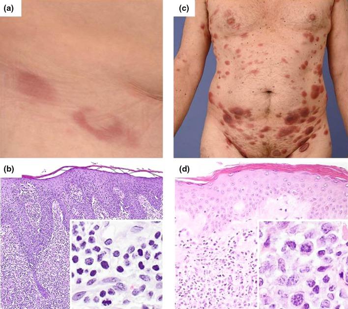 https://cdn.ncbi.nlm.nih.gov/pmc/blobs/247b/5315091/0d27771b4a0c/40487_2016_26_Fig3_HTML.jpg