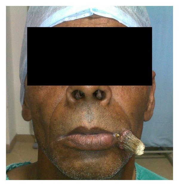 https://cdn.ncbi.nlm.nih.gov/pmc/blobs/247d/4123614/687a37a5e789/CRIONM2014-518372.001.jpg