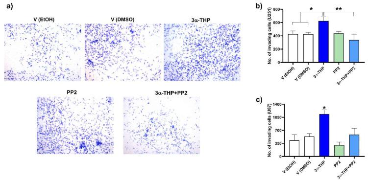 https://cdn.ncbi.nlm.nih.gov/pmc/blobs/247d/9105169/94cb8d0d1609/ijms-23-04996-g007.jpg