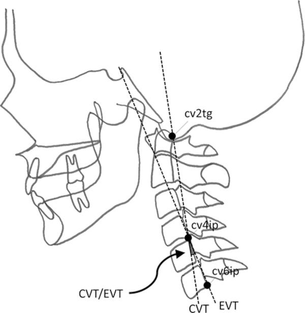 https://cdn.ncbi.nlm.nih.gov/pmc/blobs/2480/4792970/63cb26e316a1/jpts-28-339-g001.jpg