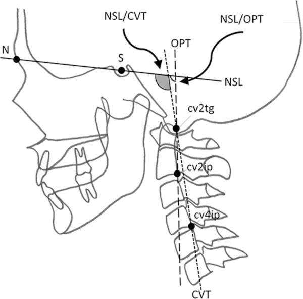 https://cdn.ncbi.nlm.nih.gov/pmc/blobs/2480/4792970/670769266a97/jpts-28-339-g002.jpg