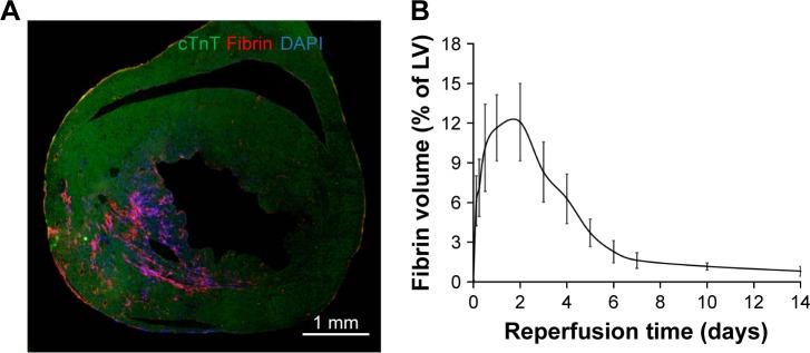 https://cdn.ncbi.nlm.nih.gov/pmc/blobs/2480/5396927/c9ae52c05123/ijn-12-3023Fig3.jpg