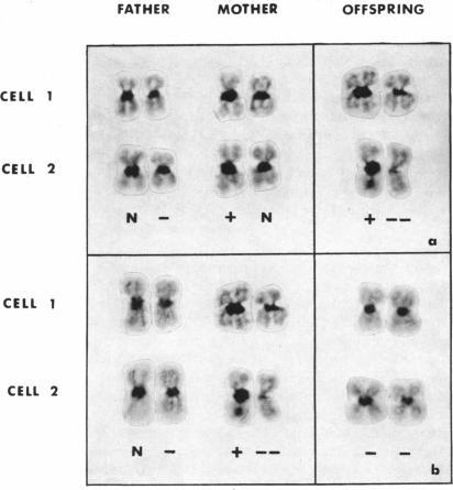 https://cdn.ncbi.nlm.nih.gov/pmc/blobs/2481/1762738/fcd67cb8dd52/ajhg00435-0051-a.jpg