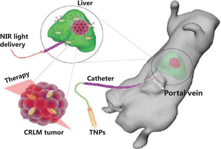 https://cdn.ncbi.nlm.nih.gov/pmc/blobs/2485/7309460/6d22be7da458/cbm-17-307-g001.jpg