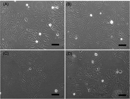 https://cdn.ncbi.nlm.nih.gov/pmc/blobs/2486/8451839/594fa1774a8c/JOR-39-1633-g007.jpg