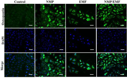 https://cdn.ncbi.nlm.nih.gov/pmc/blobs/2486/8451839/bf8c69d56364/JOR-39-1633-g004.jpg