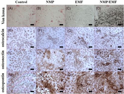 https://cdn.ncbi.nlm.nih.gov/pmc/blobs/2486/8451839/f54b4c1edd79/JOR-39-1633-g008.jpg