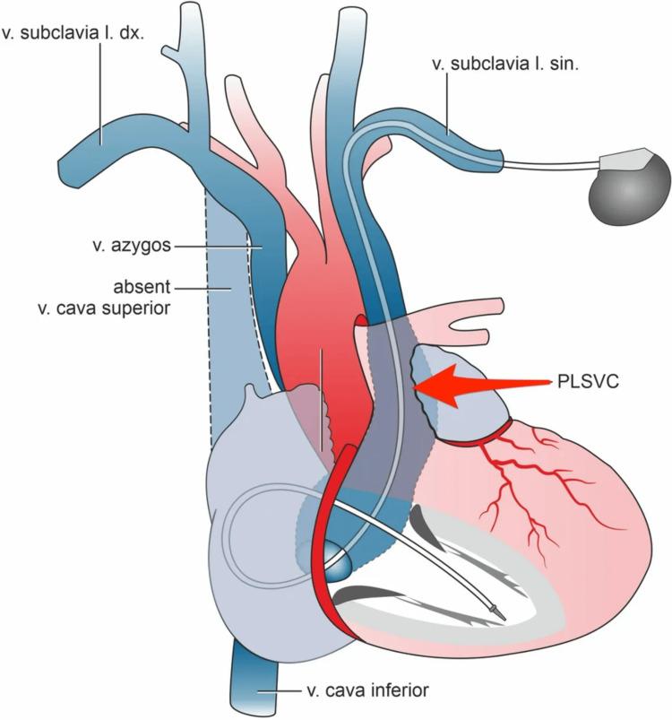 https://cdn.ncbi.nlm.nih.gov/pmc/blobs/248a/11531317/55262f8ccf13/cureus-0016-00000072865-i04.jpg