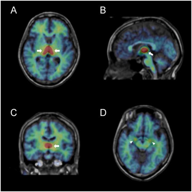 https://cdn.ncbi.nlm.nih.gov/pmc/blobs/248f/6237866/3c0aeb25ab1b/41598_2018_35065_Fig1_HTML.jpg
