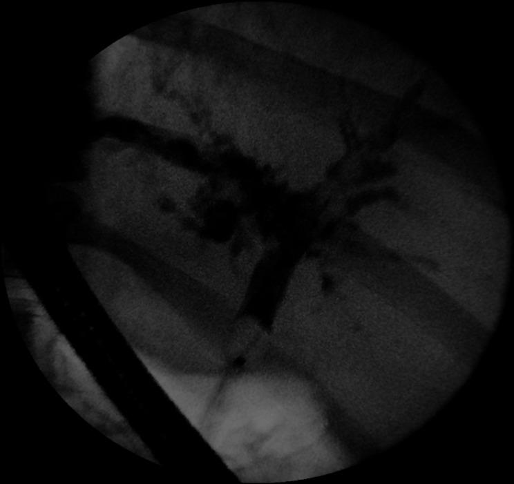 https://cdn.ncbi.nlm.nih.gov/pmc/blobs/248f/7654135/4ba32037d084/bcr-2020-237984f03.jpg