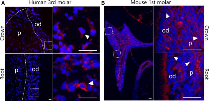 https://cdn.ncbi.nlm.nih.gov/pmc/blobs/2490/7576269/8d478aa4d734/JCMM-24-11457-g001.jpg
