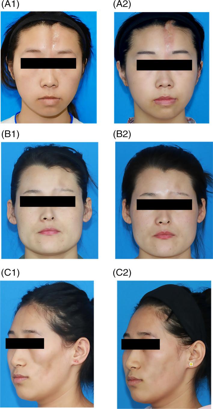 https://cdn.ncbi.nlm.nih.gov/pmc/blobs/2491/8284772/4228505d3435/SCT3-10-1148-g006.jpg