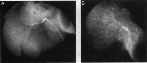 https://cdn.ncbi.nlm.nih.gov/pmc/blobs/249a/40209/913fd3a43b06/pnas01505-0230-b.jpg