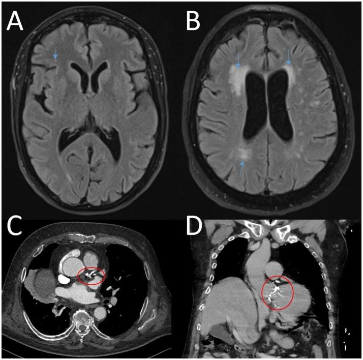 https://cdn.ncbi.nlm.nih.gov/pmc/blobs/24a2/12247173/99dbae0d5454/fnimg-04-1559481-g001.jpg