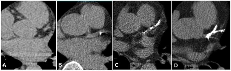 https://cdn.ncbi.nlm.nih.gov/pmc/blobs/24a2/12247173/e502f210994b/fnimg-04-1559481-g002.jpg