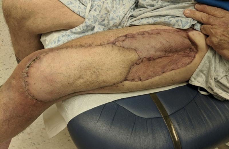 https://cdn.ncbi.nlm.nih.gov/pmc/blobs/24a7/8830920/0427d257db53/gox-10-e4107-g003.jpg