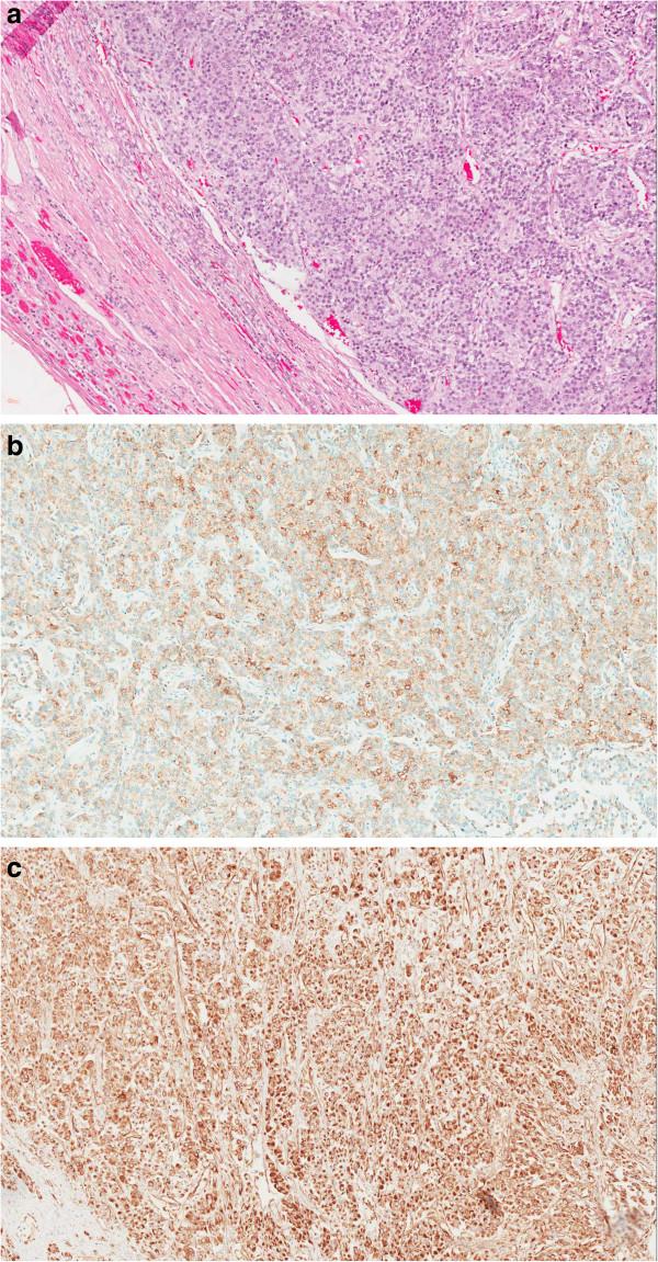 https://cdn.ncbi.nlm.nih.gov/pmc/blobs/24b8/4223740/8d847517164e/13104_2014_3289_Fig4_HTML.jpg