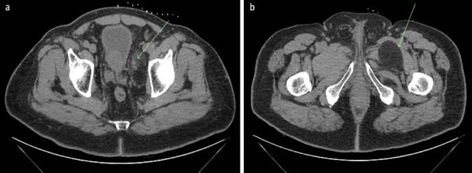 https://cdn.ncbi.nlm.nih.gov/pmc/blobs/24cd/8803248/8f67e09eeb04/bjrcr.20200162.g007.jpg