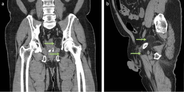 https://cdn.ncbi.nlm.nih.gov/pmc/blobs/24cd/8803248/a5c0d6cfd86f/bjrcr.20200162.g001.jpg