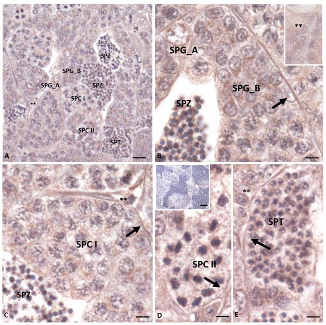 https://cdn.ncbi.nlm.nih.gov/pmc/blobs/24d3/11122137/6e16cc4774ad/ijms-25-05419-g003.jpg