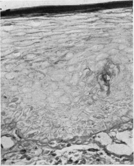 https://cdn.ncbi.nlm.nih.gov/pmc/blobs/24d7/480303/7aefdf9a8e22/jclinpath00065-0047-a.jpg