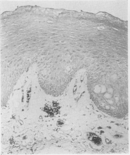 https://cdn.ncbi.nlm.nih.gov/pmc/blobs/24d7/480303/9f8e7f1e5187/jclinpath00065-0048-b.jpg