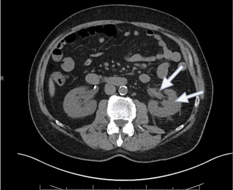 https://cdn.ncbi.nlm.nih.gov/pmc/blobs/24dc/11449379/25bcfdda5f36/cureus-0016-00000068549-i02.jpg