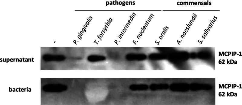 https://cdn.ncbi.nlm.nih.gov/pmc/blobs/24dc/8262937/b8a5c73a14c9/mbio.00502-21-f006.jpg