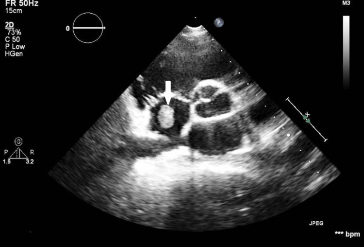 https://cdn.ncbi.nlm.nih.gov/pmc/blobs/24de/11522948/b51bd264e181/cureus-0016-00000070485-i06.jpg