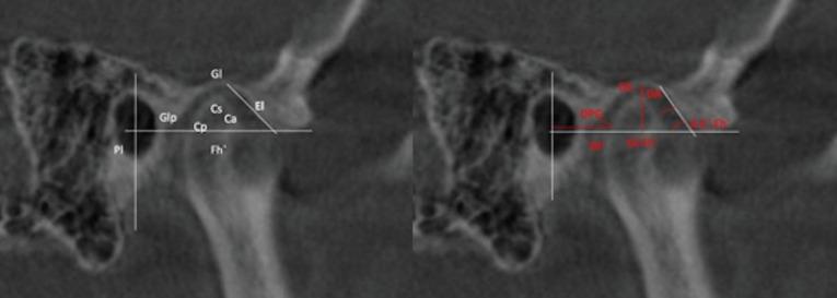 https://cdn.ncbi.nlm.nih.gov/pmc/blobs/24de/8715563/62282b572b3e/jced-13-e1216-g003.jpg