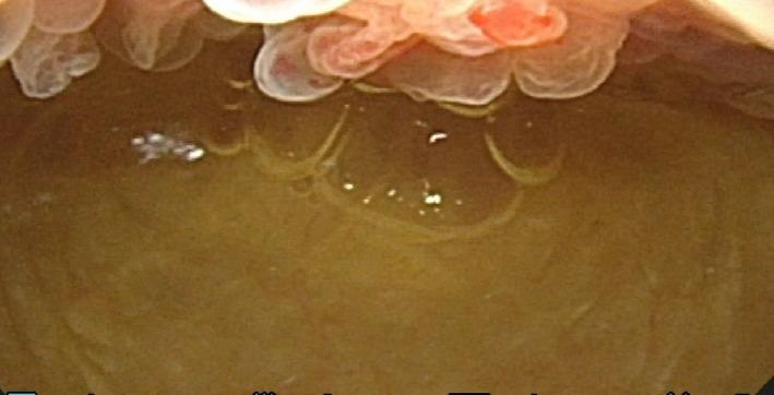 https://cdn.ncbi.nlm.nih.gov/pmc/blobs/24df/8720710/d2b6ef8dd12f/IJU5-5-36-g001.jpg