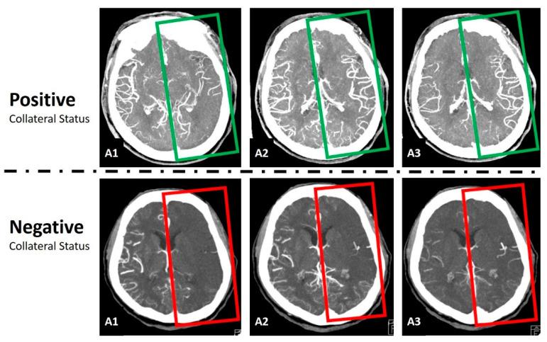 https://cdn.ncbi.nlm.nih.gov/pmc/blobs/24e0/10037617/eaab6a81da1b/tomography-09-00052-g002.jpg