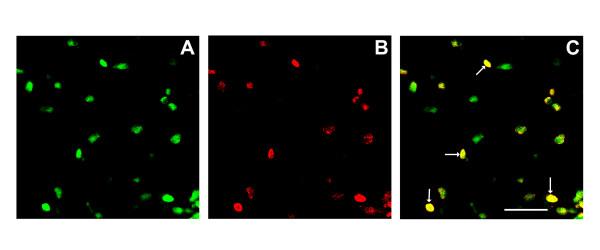 https://cdn.ncbi.nlm.nih.gov/pmc/blobs/24e8/2096620/1d5a7b05f7f6/1744-8069-3-28-7.jpg