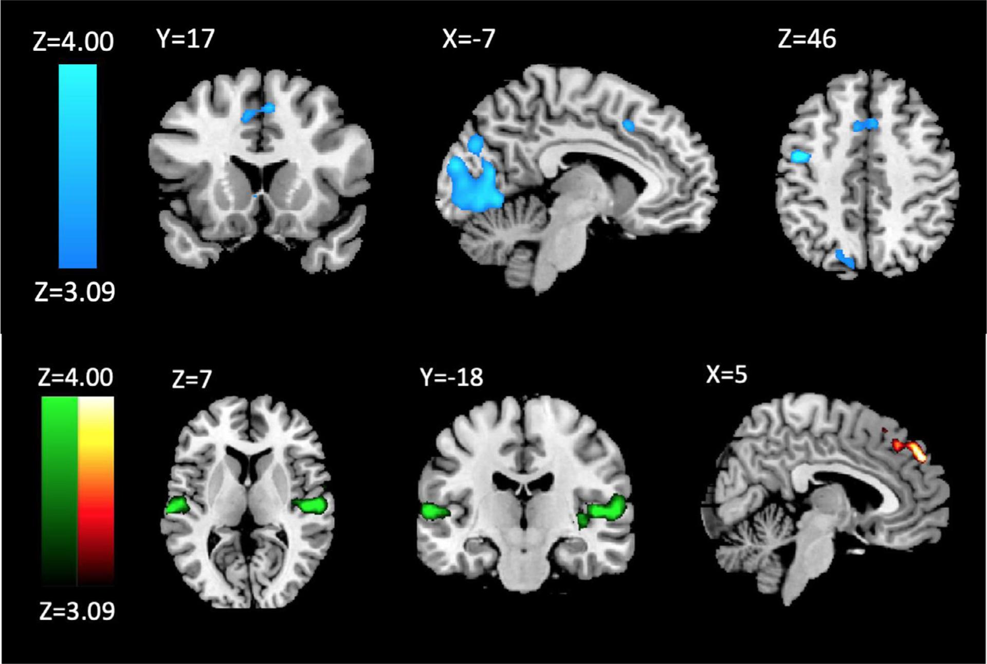 https://cdn.ncbi.nlm.nih.gov/pmc/blobs/24e8/8159858/2f9f9bd297dd/nihms-1690158-f0003.jpg