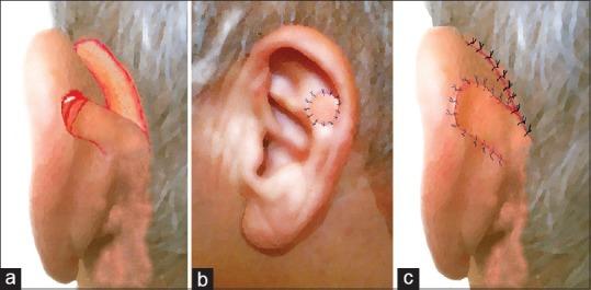https://cdn.ncbi.nlm.nih.gov/pmc/blobs/24f1/5561706/1c9500e68f5a/JCAS-10-109-g002.jpg