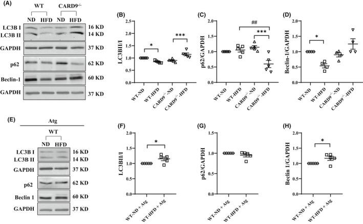 https://cdn.ncbi.nlm.nih.gov/pmc/blobs/24f1/9465182/335deb12a0c5/JCMM-26-4825-g006.jpg