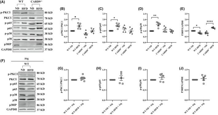 https://cdn.ncbi.nlm.nih.gov/pmc/blobs/24f1/9465182/342f4e50be39/JCMM-26-4825-g001.jpg