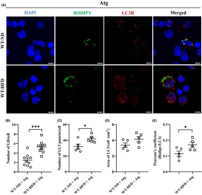 https://cdn.ncbi.nlm.nih.gov/pmc/blobs/24f1/9465182/775dedfcf8e1/JCMM-26-4825-g008.jpg