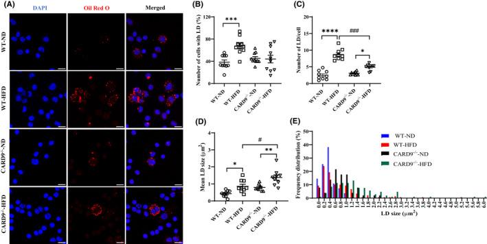 https://cdn.ncbi.nlm.nih.gov/pmc/blobs/24f1/9465182/be2c98e01b57/JCMM-26-4825-g002.jpg