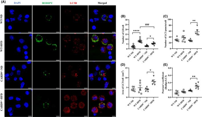 https://cdn.ncbi.nlm.nih.gov/pmc/blobs/24f1/9465182/cd3872755e5d/JCMM-26-4825-g007.jpg