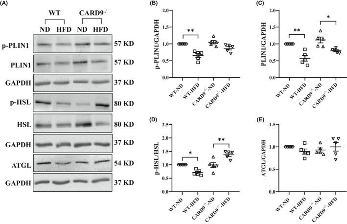 https://cdn.ncbi.nlm.nih.gov/pmc/blobs/24f1/9465182/dbdf9a91d50f/JCMM-26-4825-g005.jpg