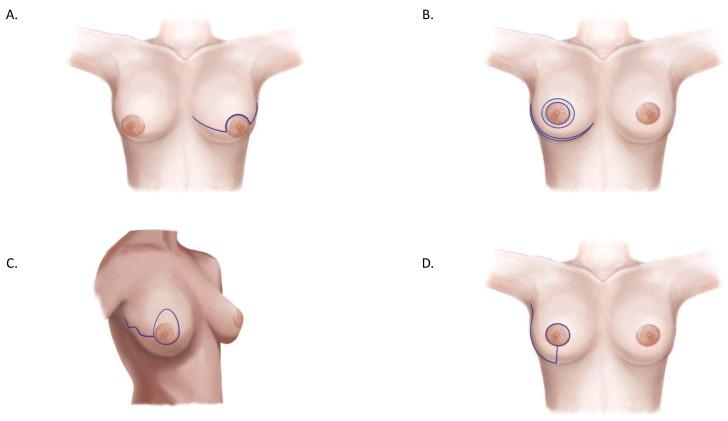 https://cdn.ncbi.nlm.nih.gov/pmc/blobs/24f3/11855976/6fb33707ab16/jcm-14-01350-g005.jpg