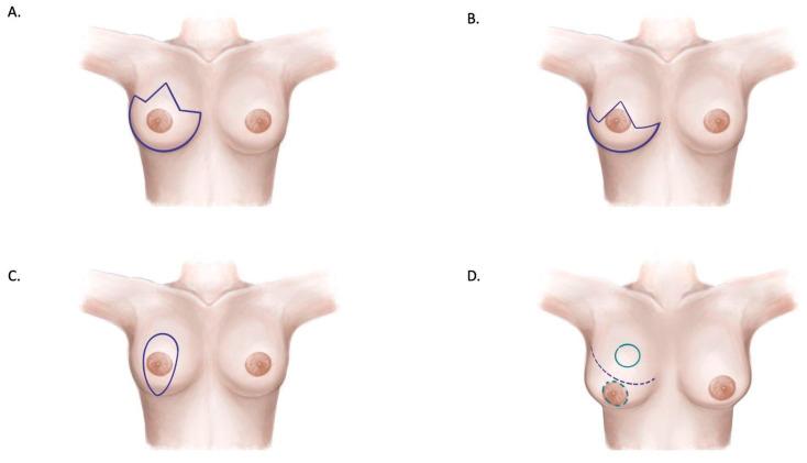 https://cdn.ncbi.nlm.nih.gov/pmc/blobs/24f3/11855976/bffe65e64f73/jcm-14-01350-g004.jpg