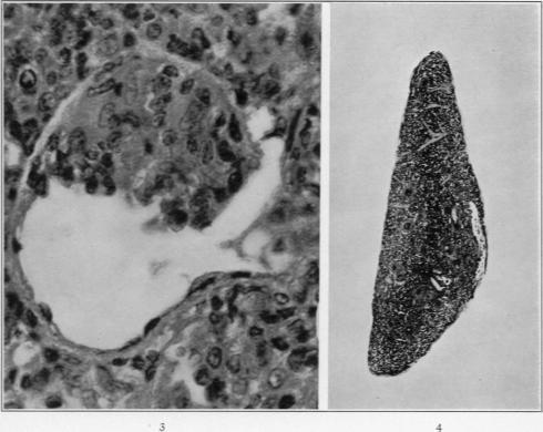 https://cdn.ncbi.nlm.nih.gov/pmc/blobs/2501/2062807/ac7cf8184700/amjpathol00730-0117-a.jpg