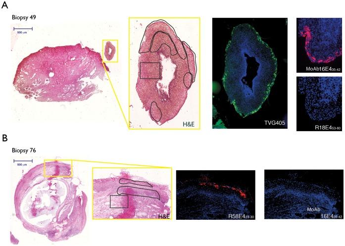 https://cdn.ncbi.nlm.nih.gov/pmc/blobs/2501/3513315/93d25e7f257e/pone.0049974.g006.jpg