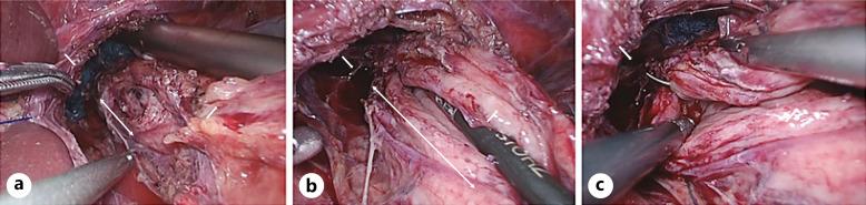 https://cdn.ncbi.nlm.nih.gov/pmc/blobs/2503/9251456/0c6619aa939c/crg-0016-0406-g04.jpg