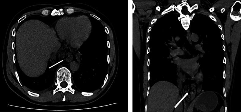 https://cdn.ncbi.nlm.nih.gov/pmc/blobs/2503/9251456/81b56194728a/crg-0016-0406-g01.jpg