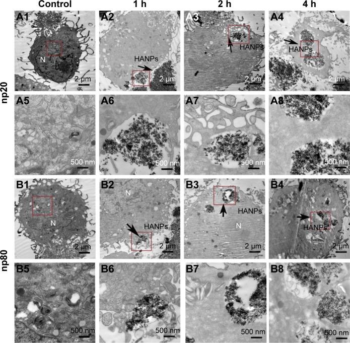 https://cdn.ncbi.nlm.nih.gov/pmc/blobs/250b/5856024/d3a2485bd7b6/ijn-13-1457Fig4.jpg