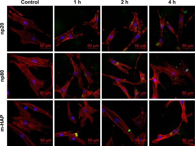 https://cdn.ncbi.nlm.nih.gov/pmc/blobs/250b/5856024/dc58bab0181f/ijn-13-1457Fig5.jpg